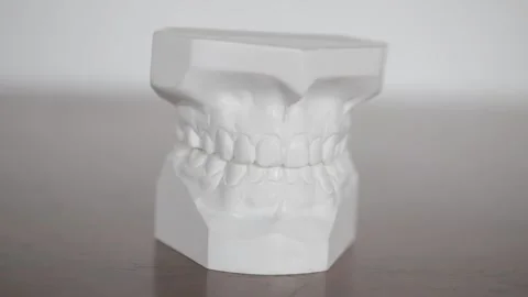 Gypsum dental casting model from a man's teeth used for surgery study Stock-Footage 169975802