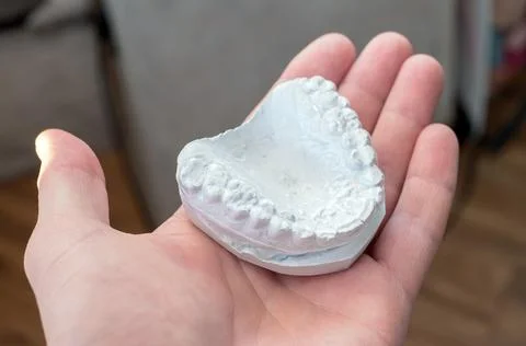 Gypsum human teeth, teeth model for caps. or aligner. Stock Photos