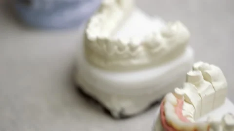 Gypsum models of teeth Stock Footage 147226541