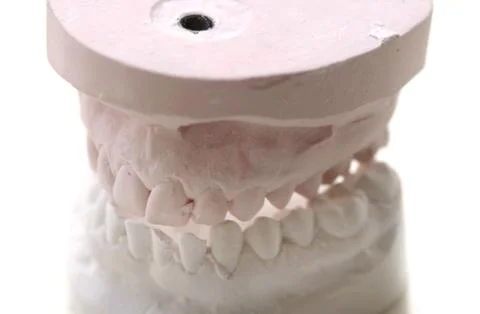 Gypsum teeth 写真素材