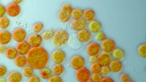  Haematococcus and Colpoda, Microalgae and Ciliate, DIC Vibrant Microscopy Stock Footage 319396548