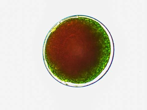 Haematococcus pluvialis algae under microscopic view Stock Photos