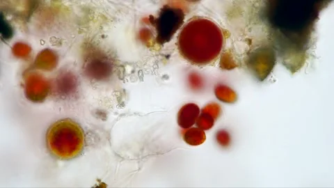 Haematococcus Pluvialis Cell Division Timelapse, Astaxanthin Stock Footage 319390807