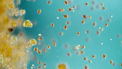 Haematococcus Pluvialis - DIC Microscopy, Green Algae with Astaxanthin Stock Footage 319075603