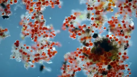 Haematococcus Pluvialis Microalgae, Astaxanthin Source, Vibrant Microscopy 20X Stock Footage 320809625