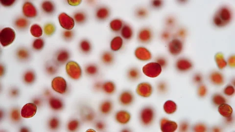 Haematococcus Pluvialis Microalgae, Astaxanthin Source, Vibrant Microscopy Stock Footage 320855607