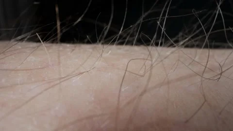 Hair on body Stock Footage 236990319