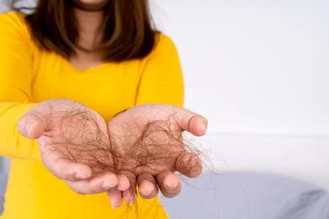Hair fall problem, closeup hand holding problem hair. Healthcare medical or d Stock Photos