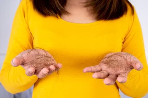 Hair fall problem, closeup hand holding problem hair. Healthcare medical or d Stock Photos