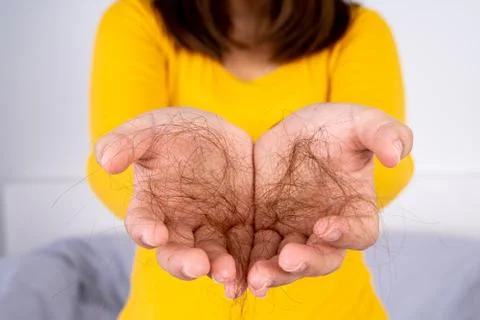 Hair fall problem, closeup hand holding problem hair. Healthcare medical or d Stock Photos