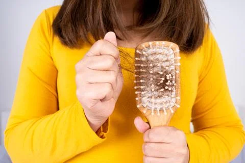 Hair fall problem, closeup hand holding comb and problem hair. Healthcare med Stock Photos