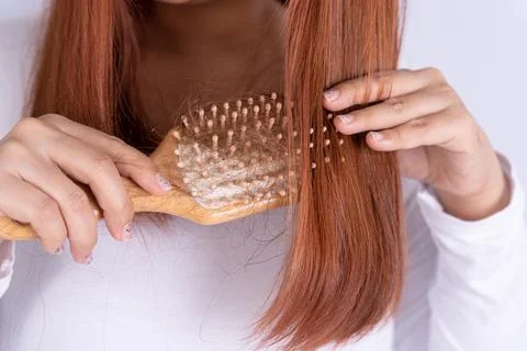 Hair fall problem, closeup hand holding comb and problem hair. Healthcare med Stock Photos