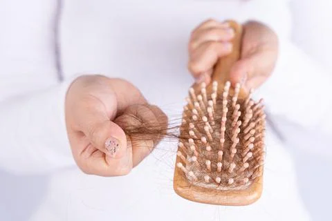 Hair fall problem, closeup hand holding comb and problem hair. Healthcare med Stock Photos