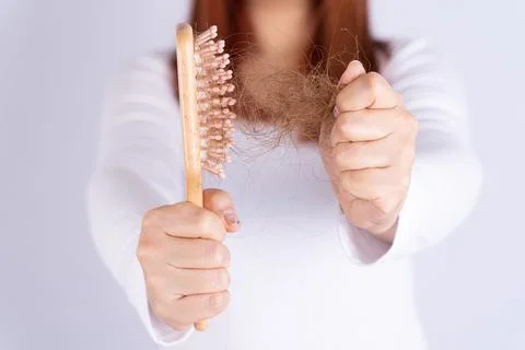 Hair fall problem, closeup hand holding comb and problem hair. Healthcare med Stock Photos
