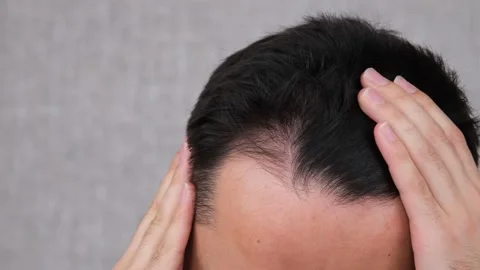 Hair loss checking Stock Footage 265079809