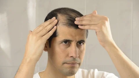 Hair loss Vidéo 75779749