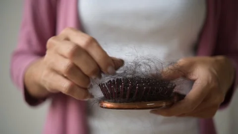 Hair loss problem Stock Footage 92800227