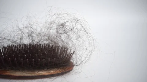 Hair loss problem Stock Footage 92800339