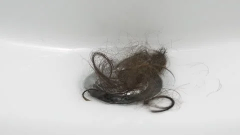 Hair loss problem Vidéo 314948031
