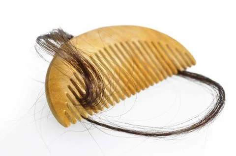 Hair loss problem Stock Photos