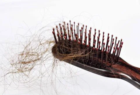 Hair loss problem Stock Photos