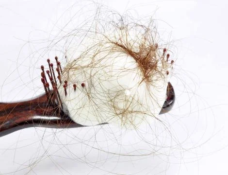 Hair loss problem Stock Photos