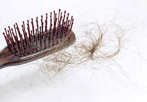 Hair loss problem Stock Photos