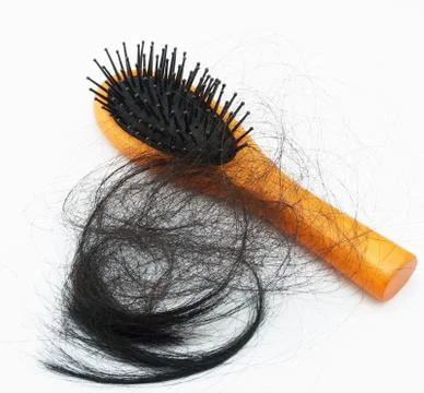 Hair loss problem Stock Photos