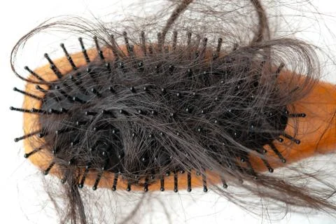 Hair loss problem. Stock Photos
