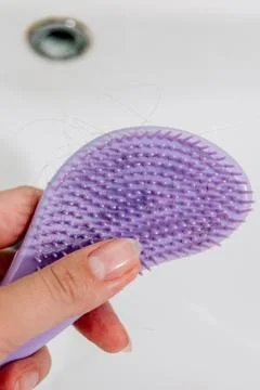 Hair loss problem when combing head, broken dry damaged hair on brush and sin Stock-Fotos