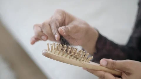 Hair loss problems while brushing hair at home Stock Footage 333724397