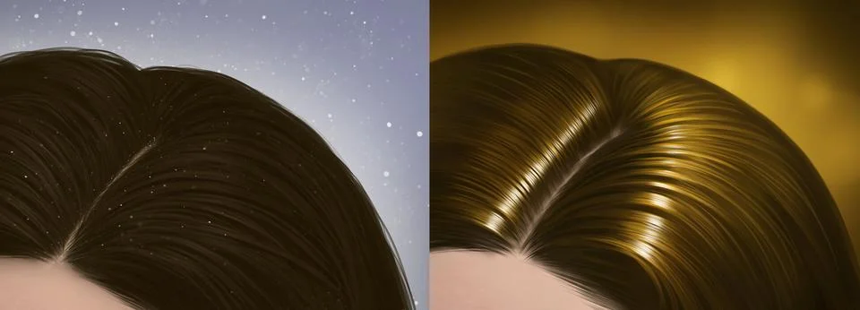 Hair problem - The difference between before and after dandruff problems and Stock Illustration
