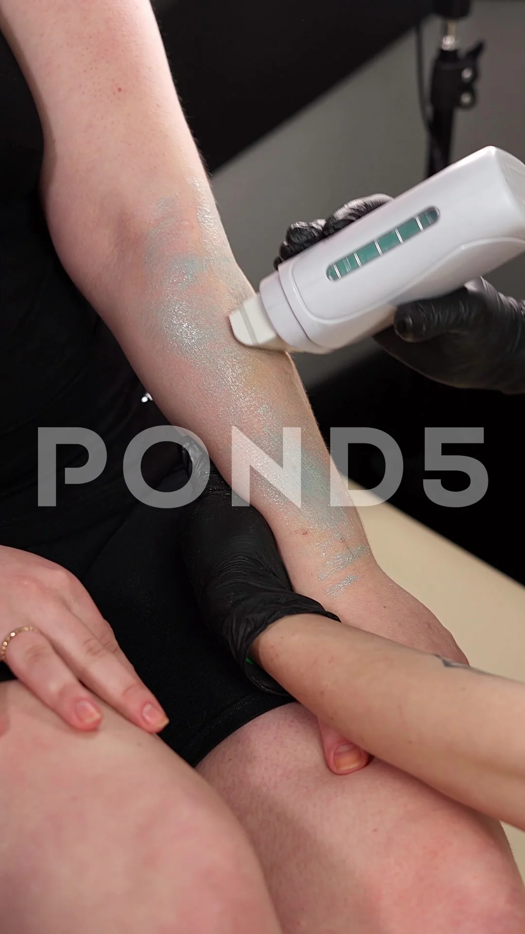 Hair Removal master Applying Wax to the client s hand. Vertical video 9 16