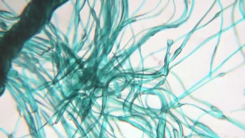 Hair seen under a microscope Stock Footage 69233632
