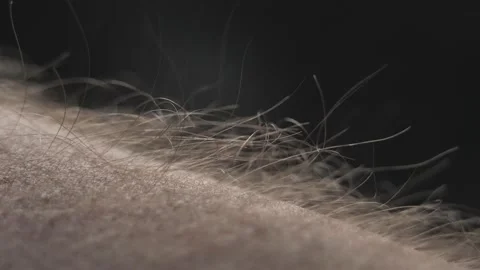 Hair is standing on the forearm. Stock Footage 150022700