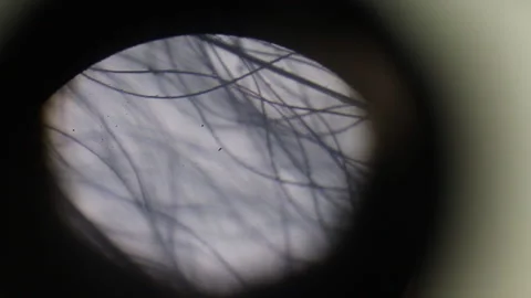 Hair under the microscope Video stock 172473209