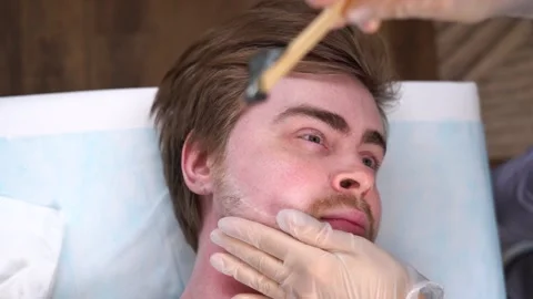 Hairy face man using wax epilation  beauty saloon. Body hair removal wax warmer Vidéo 149583753