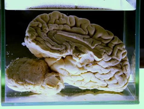 Half of the human brain in the jar Stock Photos