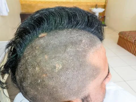 Half shaved head of a young an attractive man by hair trimming machine Stock Photos