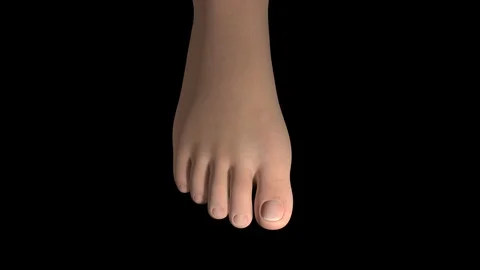 Hallux Valgus Deformity Video stock 122733690