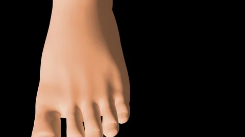 Hallux Valgus Stock Footage 121093103