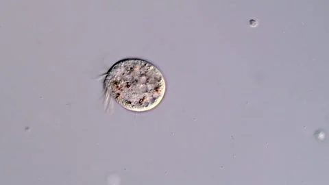 Halteria ciliophora under microscope view 库存影片 310642118
