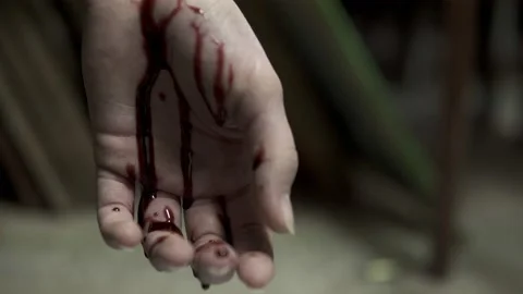Hand after suicide Stock Footage 171656402