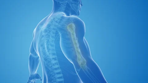 Hand and Upper Extremity Pain Stock Footage 244161643