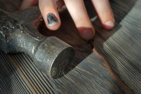 Hand with blackened thumbnail over a hammer Stock Photos
