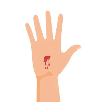 Hand with bleeding cut. Palm wound. Injury icon isolated on white background Stock-Illustration
