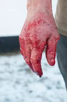 Hand with blood Stock Photos