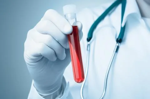 Hand with blood sample Stock Photos