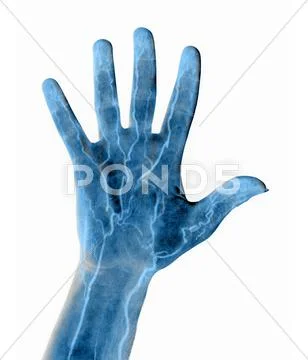 Hand blood supply, artwork Stock Illustration