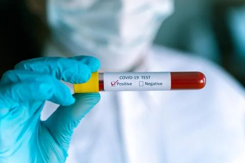 Hand in blue glove holding Test vial with Sample blood test of Coronavirus (C Foto stock